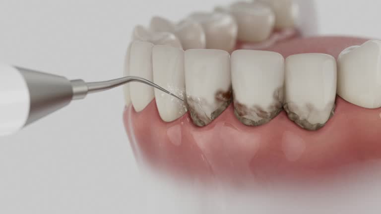 Trusted Dental Crowns And Bridges service in South Browning, MT - Dentist Open Now
